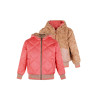 NoNo Bomby Reversible Hooded Bomber Jacket Blushy Cheeks